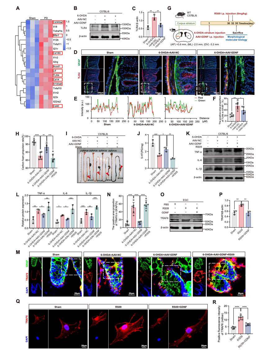 GDNF attenuates enteric glial inflammation and improves colonic function via inhibiting the TLR4-TRAF6 pathway GDNF attenuates enteric glial inflammation and improves colonic function via inhibiting the TLR4-TRAF6 pathway